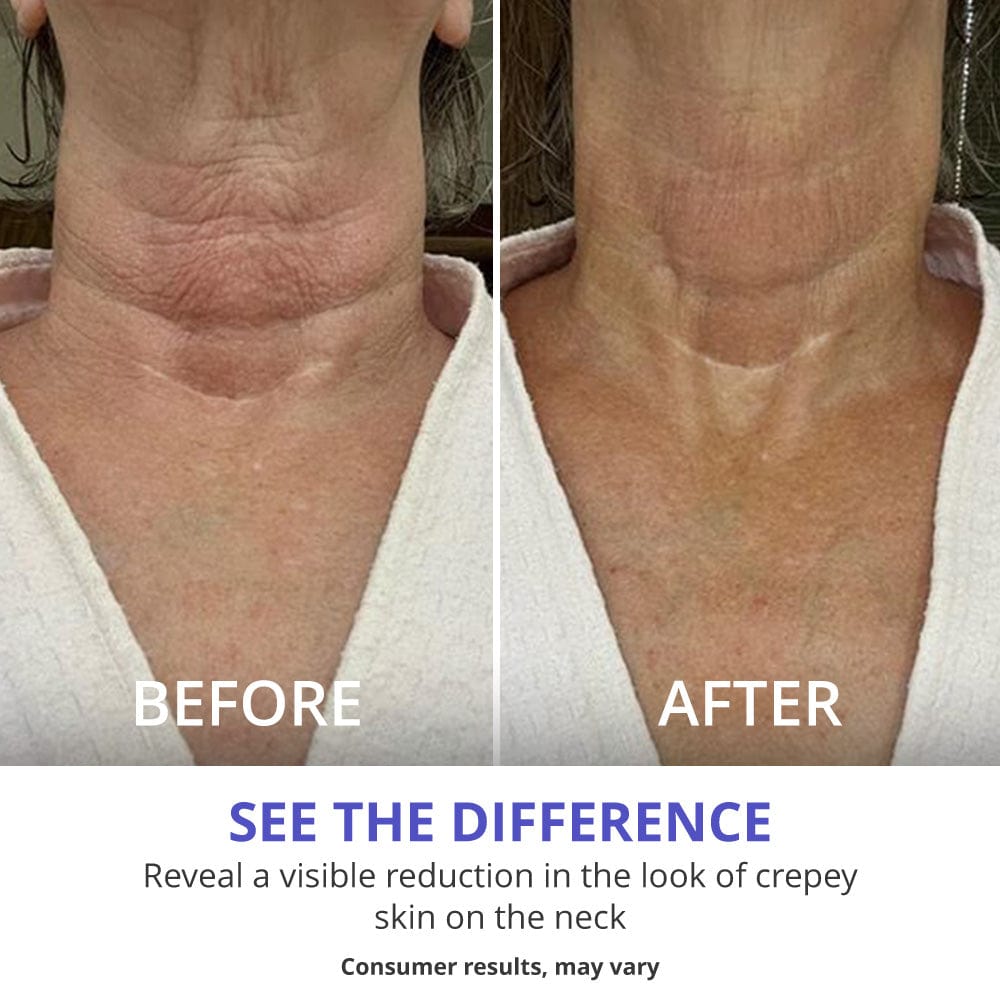 Tighten &amp; Lift Neck Cream