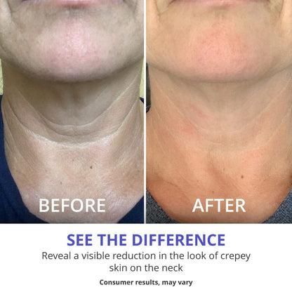 Tighten &amp; Lift Neck Cream