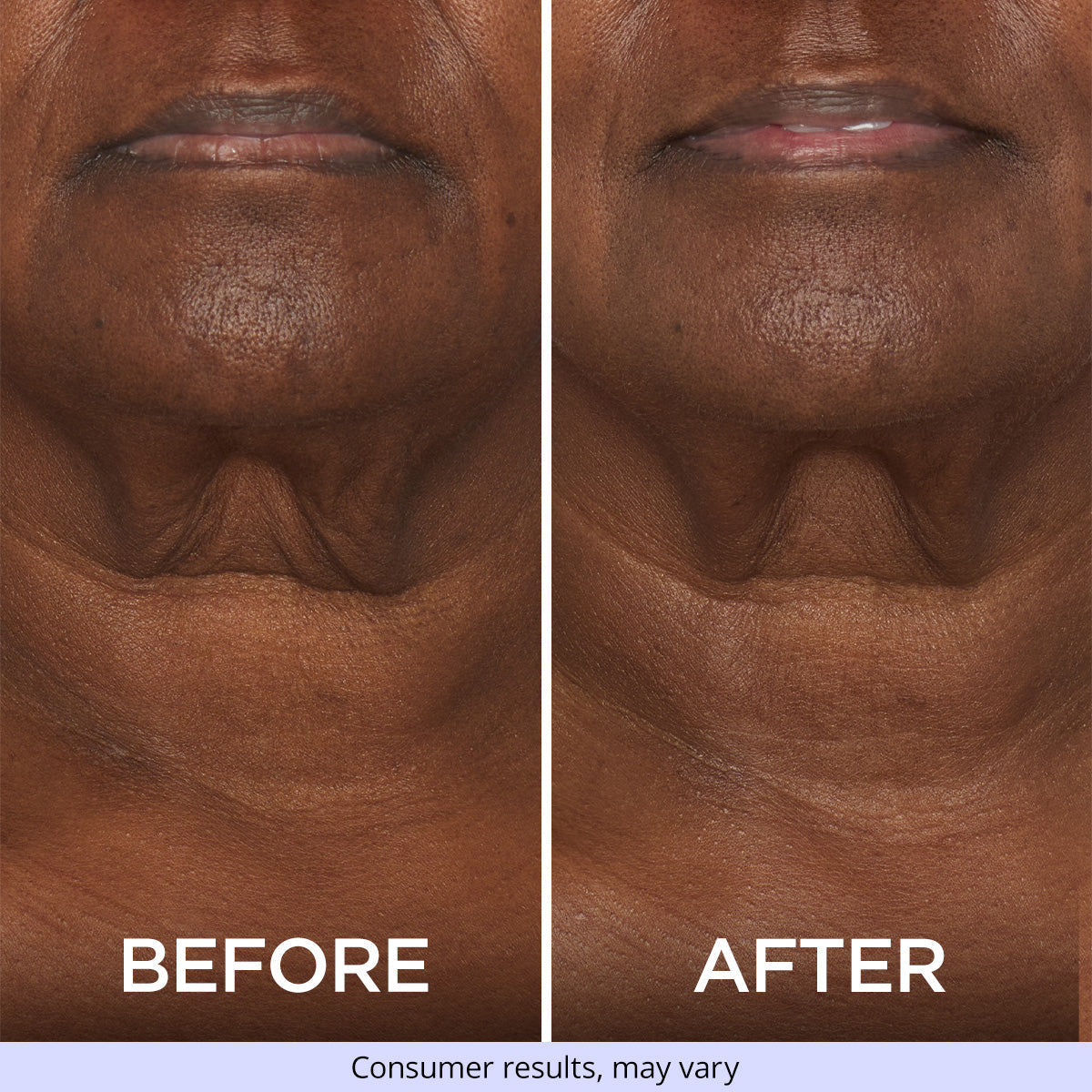 Tighten &amp; Lift Neck Cream