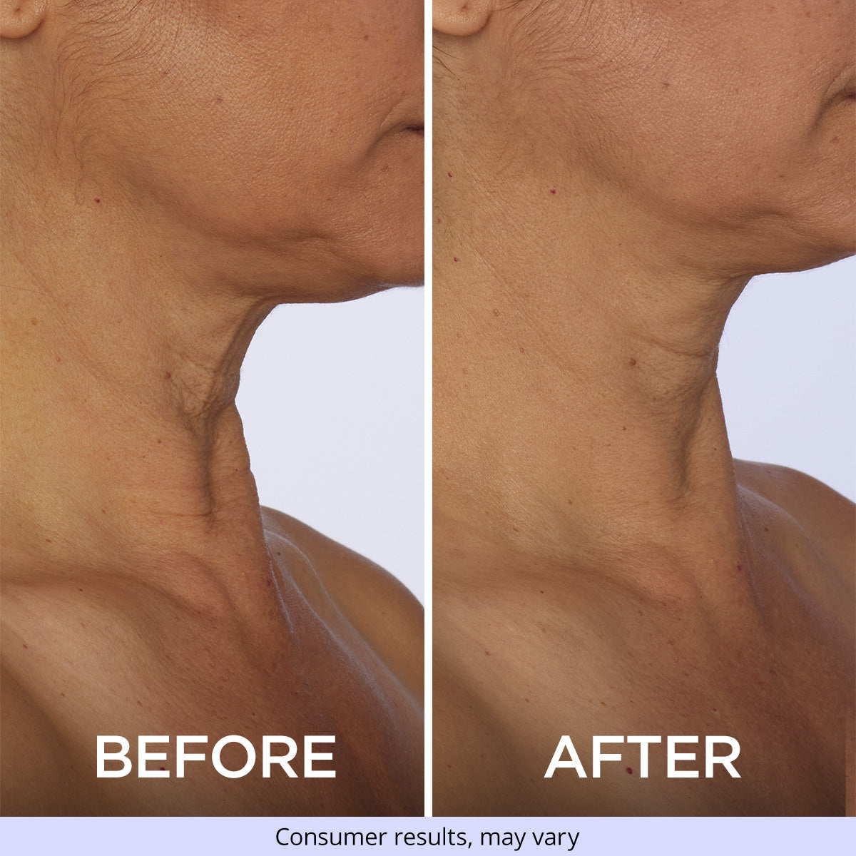 Tighten &amp; Lift Neck Cream